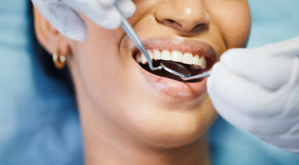 Best Emergency Tooth Extraction in Mccamey, TX